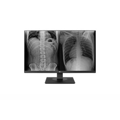 LG 27" Ultra HD 16:9 8mp Height Adjustable Clinical Review Monitor