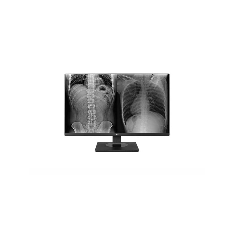 LG 27" Ultra HD 16:9 8mp Height Adjustable Clinical Review Monitor