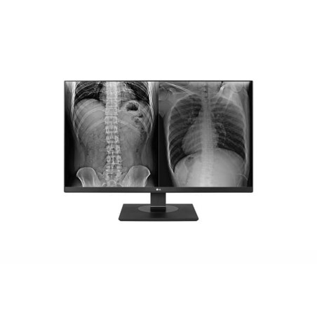 LG 27" Ultra HD 16:9 8mp Height Adjustable Clinical Review Monitor