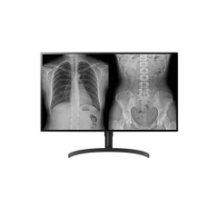 LG 32" 16:9 8MP 4K Ultra HD/NANO IPS Diagnostic Monitor