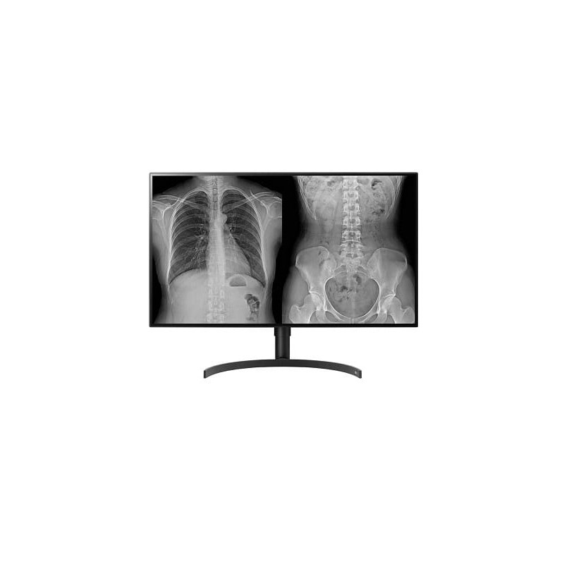 LG 32" 16:9 8MP 4K Ultra HD/NANO IPS Diagnostic Monitor