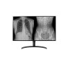 LG 32" 16:9 8MP 4K Ultra HD/NANO IPS Diagnostic Monitor