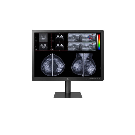LG 31HN713D-B 31" 12MP IPS Diagnostic Monitor for Mammography with Multi-resolution Modes, Pathology Mode, Self-calibration, Foc