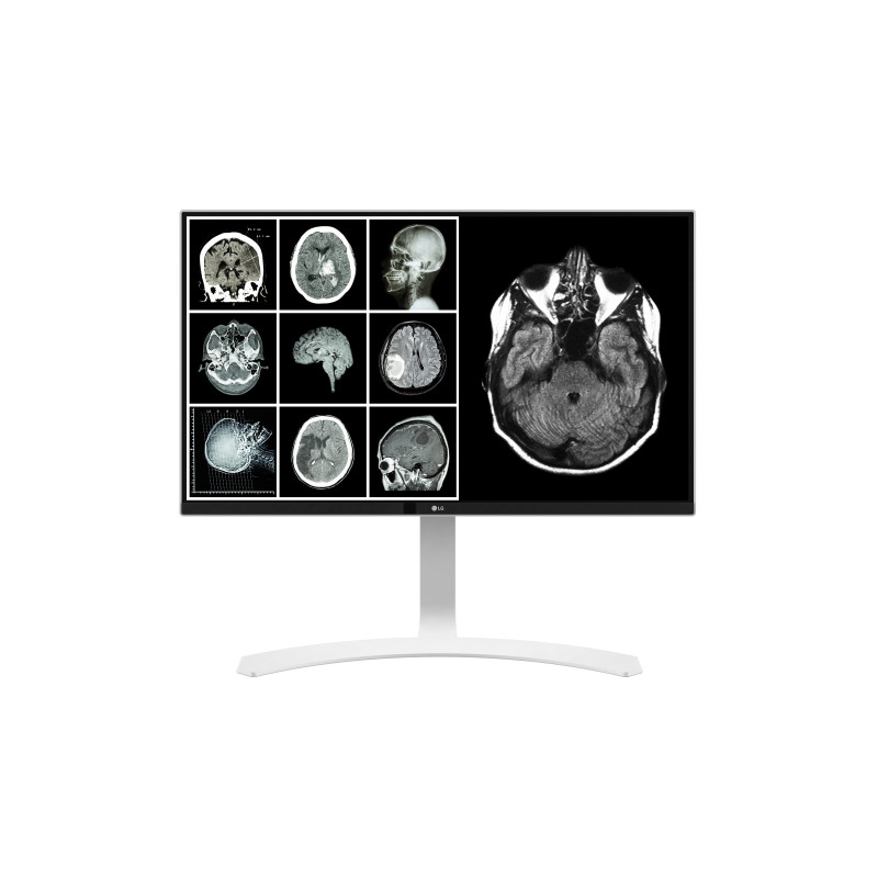 LG 27HJ712C-W 27" 4K UHD LCD Clinical Review Monitor