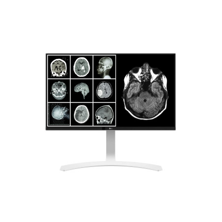 LG 27HJ712C-W 27" 4K UHD LCD Clinical Review Monitor