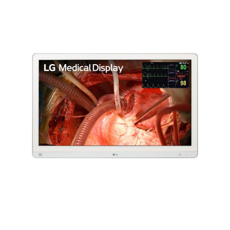 LG 27HQ710S-W 27" 4K Surgical Monitor with Mini-LED