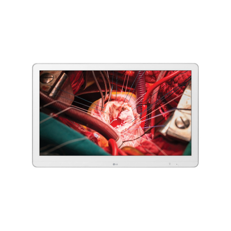 LG 27HK510S-W 27" FHD IPS Surgical Monitor