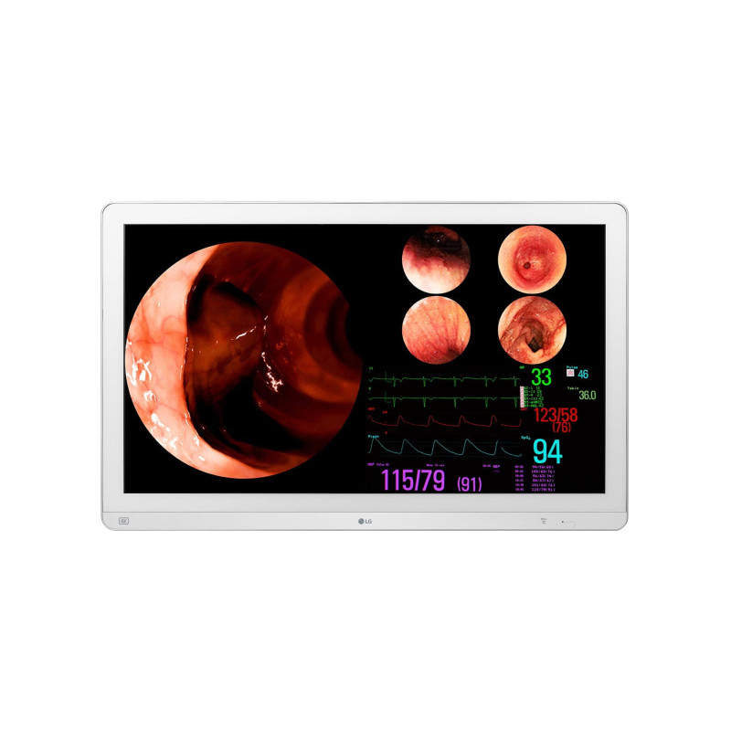 LG 32GL710S-W 31.5" 4K IPS Surgical Monitor