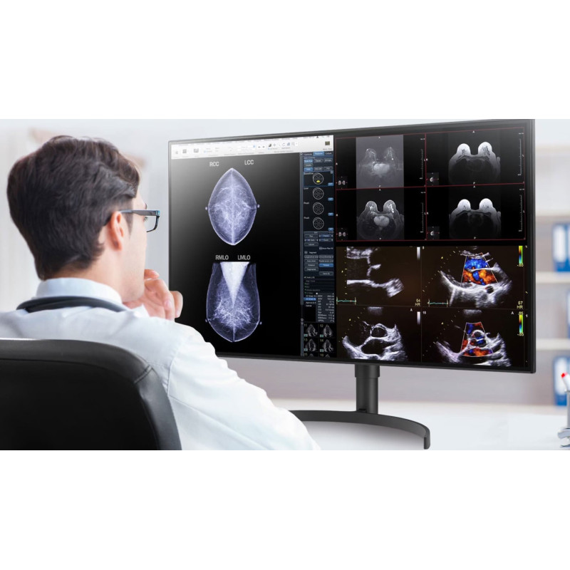 LG 32HL512D-B 32" 8MP IPS Diagnostic Review Monitor