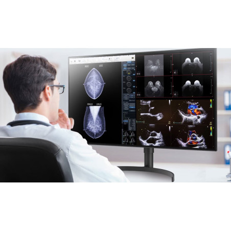 LG 32HL512D-B 32" 8MP IPS Diagnostic Review Monitor