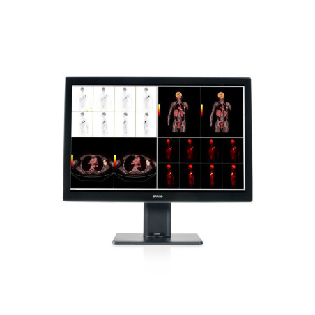 Barco MDCC-6530 30.4" 6MP IPS Color Medical Diagnostic Radiology Monitor - Black/White