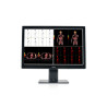 Barco MDCC-6530 30.4" 6MP IPS Color Medical Diagnostic Radiology Monitor - Black/White